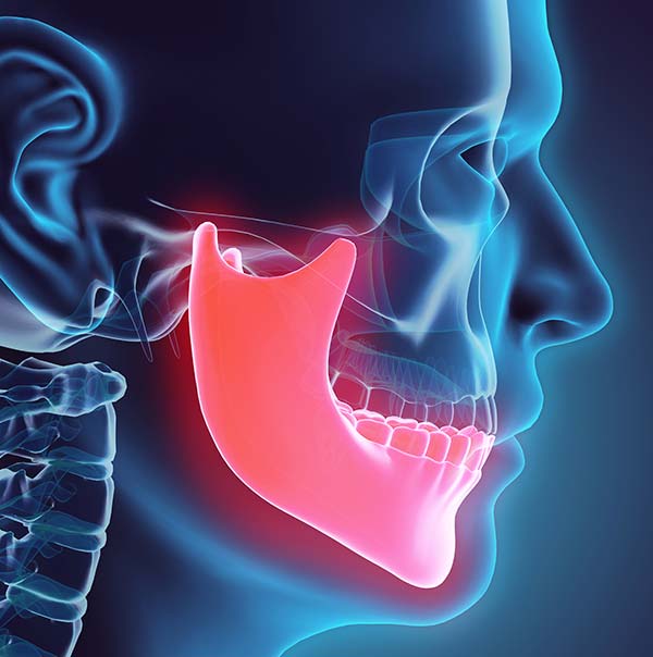 Teeth Grinding Treatments Gympie